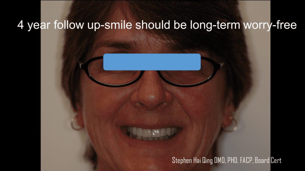 Implant-supported crown and bridge prosthesis  patient